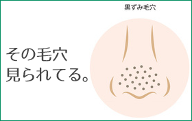 毛穴の黒ずみ撃退