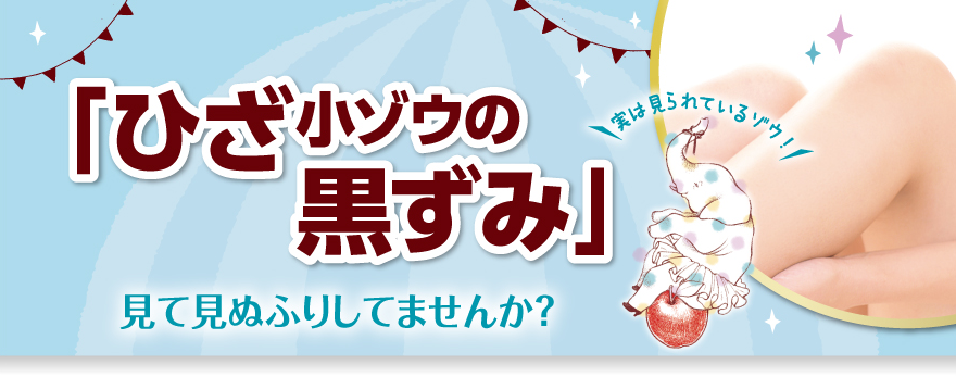 「ひざ小ゾウの黒ずみ」見て見ぬふりしてませんか？