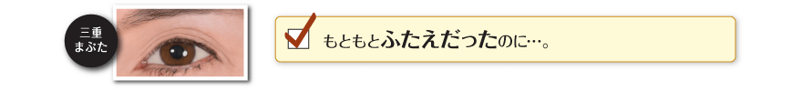 もともとふたえだったのに…。