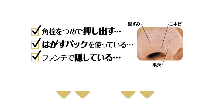 イチゴ鼻に こんなお手入れは危険！