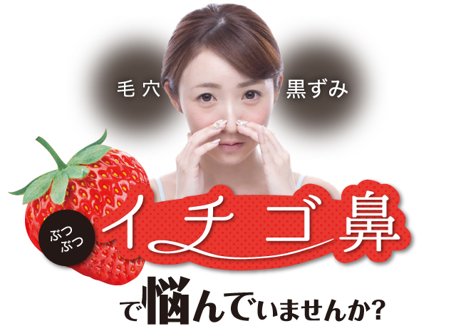 イチゴ鼻で悩んでいませんか？