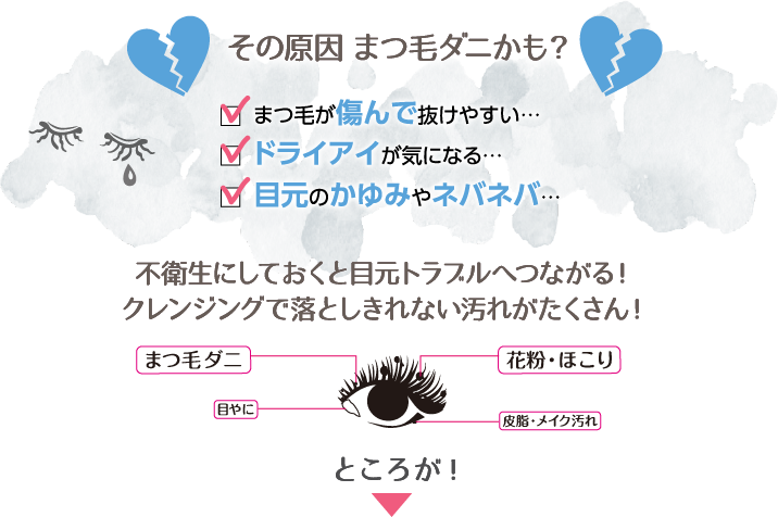 その原因 まつ毛ダニかも？