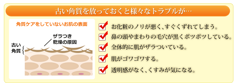 �Â��p��������Ă����Ɨl�X�ȃg���u����...